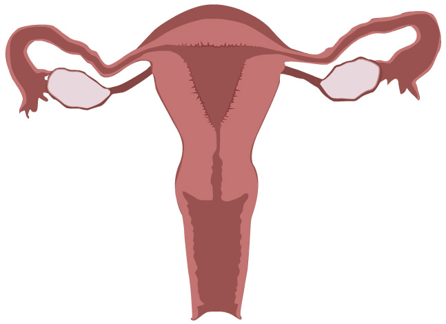 Endometrial Cancer