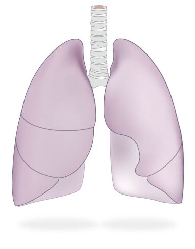 Lung cancer
