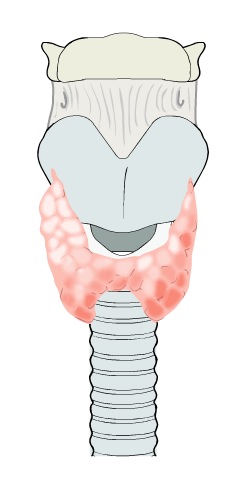 Thyroid cancer